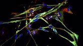 Foto: Logran transformar células de un cáncer pediátrico agresivo en células musculares sanas y funcionales