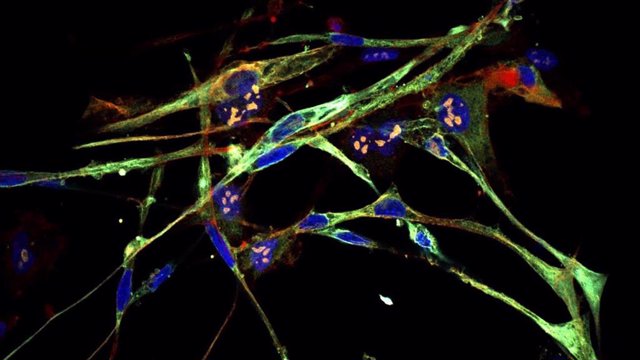 Células De Rabdomiosarcoma Convertidas En Células Musculares.