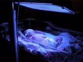 Foto: Fototerapia en bebés, ¿qué es y para qué sirve?