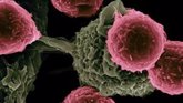 Foto: La primera terapia dirigida con microARN ralentiza el crecimiento de tumores cancerosos