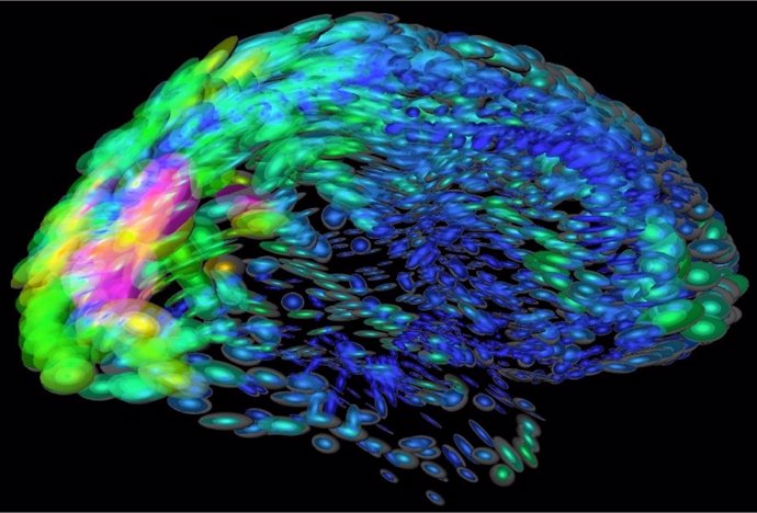 Archivo - Imagen del cerebro que muestra en distintos colores las regiones con diferentes funciones.