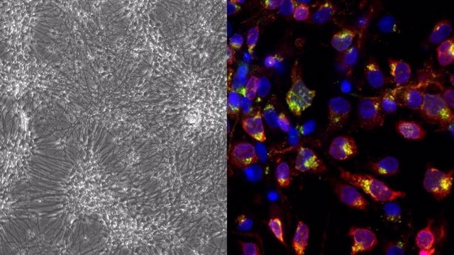 A la izquierda, una fotografía tomada con el microscopio de contraste de fases de un cultivo diferenciado de células ReN.  A la derecha, una imagen de inmunofluorescencia de un cultivo de células ReN diferenciado e infectado por HSV-1.