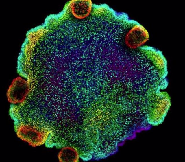Imagen de microscopía confocal de núcleos, coloreados según la profundidad, de Trichoplax sp. H2, una de las cuatro especies de placozoos para las que los autores del estudio crearon un atlas celular