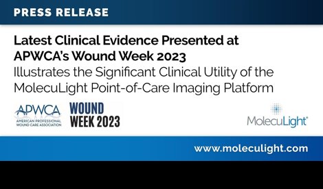 Comunicados Internacional