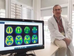 Archivo - La Unidad de Deterioro Cognitivo está coordinada por el especialista Félix Viñuela, neurólogo experto en neurología cognitiva y conductual.