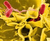 Foto: Descubren un nuevo microbio intestinal que produce gases tóxicos malolientes pero protege contra patógenos