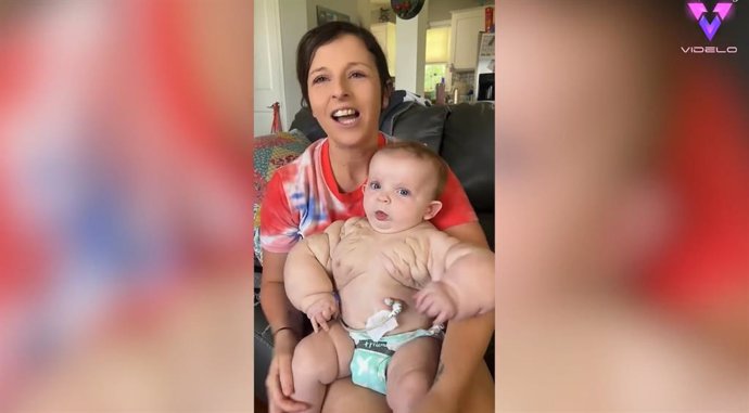 Una adorable niña ha sido apodada "Baby Hulk" después de que una extraña enfermedad le hiciera nacer con el pecho y los brazos anormalmente grandes.