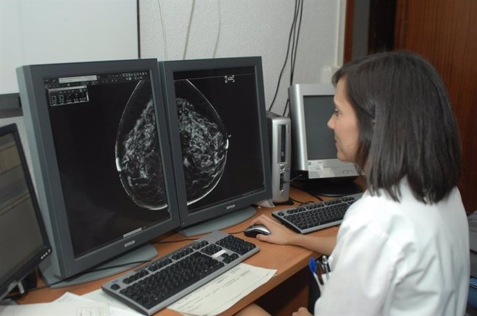 Archivo - El SAS implanta un sistema de información centralizado para la detección precoz del cáncer de mama