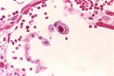 Foto: La exposición previa al citomegalovirus protege contra los defectos congénitos y el aborto espontáneo