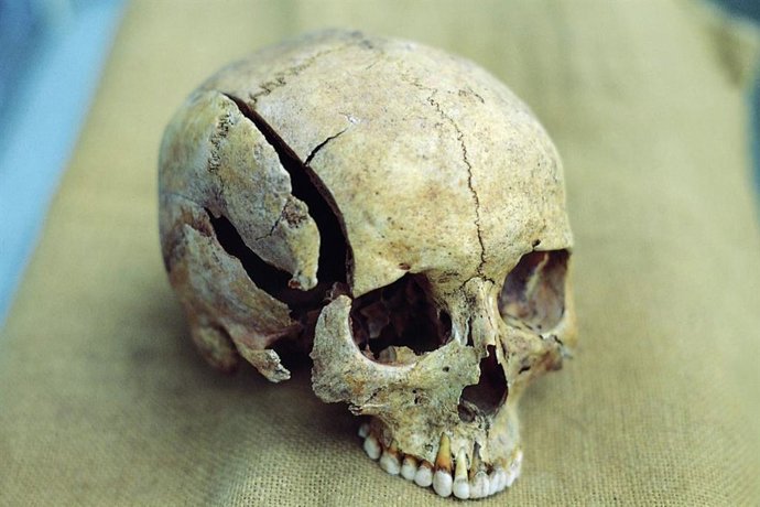 Un traumatismo craneal es testigo de una muerte violenta.