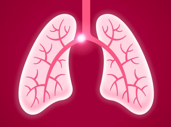 Archivo - Embolia pulmonar