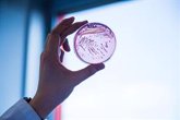 Foto: Una cepa de 'E. coli' multirresistente combate las bacterias del intestino sano