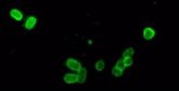 Foto: El control de la forma celular abre nuevas vías terapéuticas frente a las infecciones por 'Salmonella'