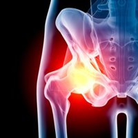 Médicos de Familia alertan del incremento del 29% en 2034 de la osteoporosis debido al envejecimiento de la población