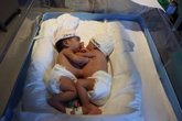 Foto: El H. Sant Joan de Déu, de Barcelona, operará a dos siamesas recién nacidas para separar sus cuerpos
