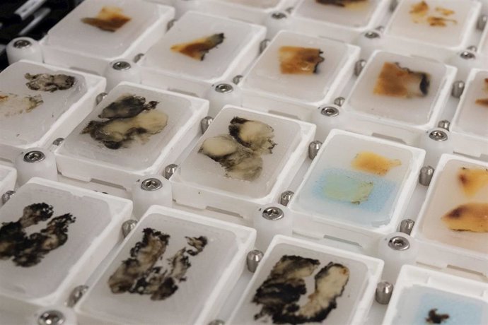 Cortes histológicos hechos con el robot