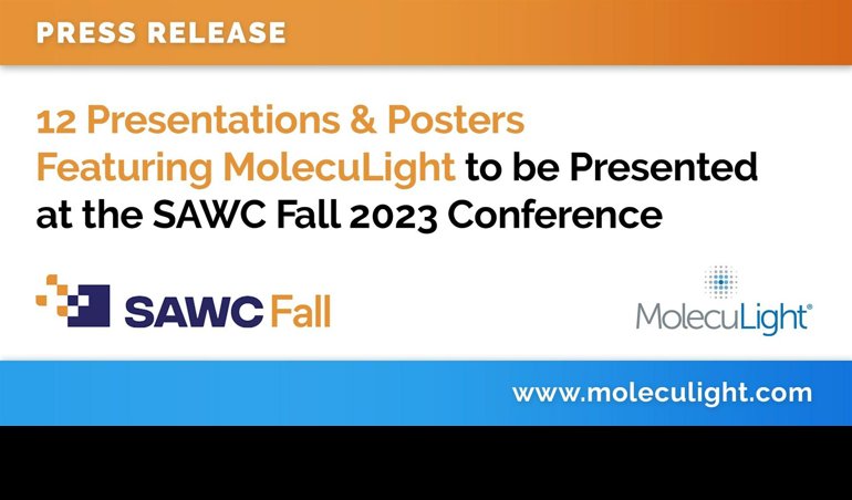 Comunicados Internacional