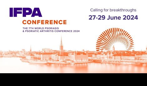 Comunicados Internacional