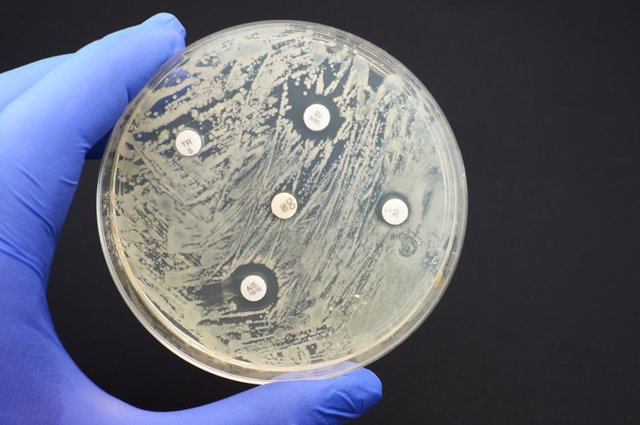 Archivo - Detección de la resistencia a los antimicrobianos mediante la prueba de difusión de Kirby Bauer