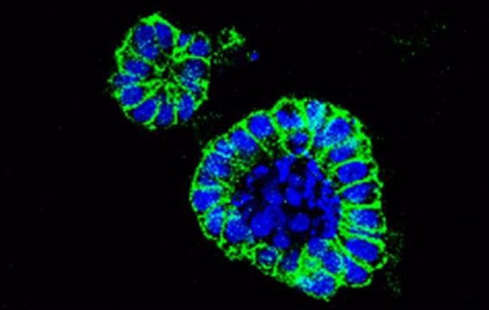 Organoide de cáncer de colon