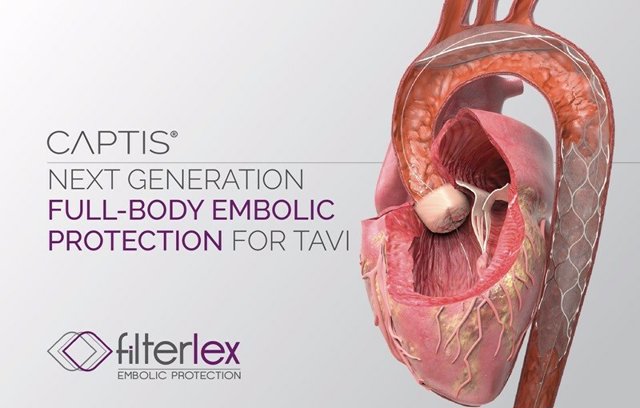 In the new study published in EuroIntervention, Filterlex Medical’s CAPTIS system captured a high number of embolic debris particles, showing promise in providing embolic protection and enhancing safety during TAVR procedures.