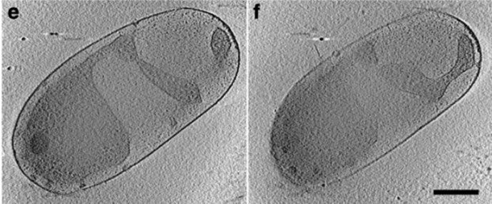 Desvelado el mapa de genes esenciales de la bacteria Planctopirus limnophila.