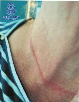 Una de las víctimas del robo al tirón de joyas