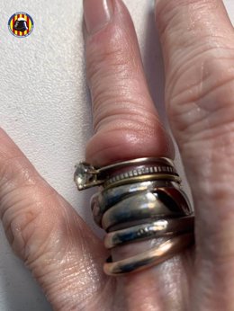 Bomberos retiran a una mujer seis anillos que aprisionaban su dedo anular