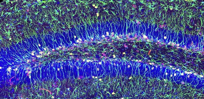Imagen de microscopía confocal mostrando las células madre neurales del hipocampo