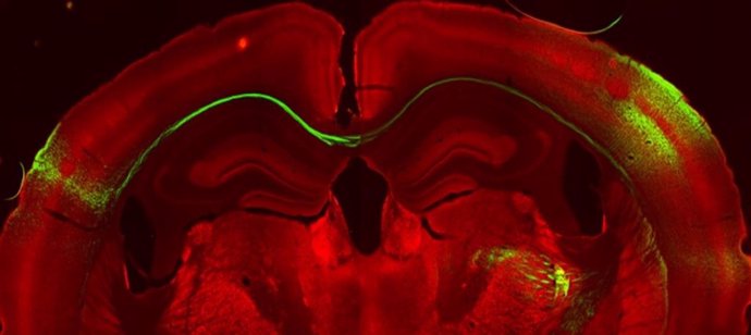 Neuronas de un hemisferio de la corteza somatosensorial primaria proyectan hacia el otro hemisferio.
