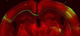 Foto: Describen en un estudio "pionero" cómo la información sensorial se transmite entre los hemisferios del cerebro