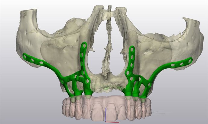 Metodologías para abordar el ciclo de vida