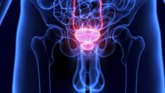 Foto: Por qué algunos cánceres de próstata se vuelven resistentes a la terapia hormonal