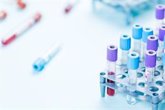 Foto: La Comisión Europea designa tres laboratorios españoles de referencia en el ámbito del diagnóstico 'in vitro'