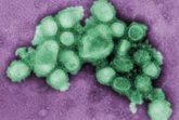 Foto: Un nuevo tipo de anticuerpo, prometedor contra múltiples formas del virus de la gripe