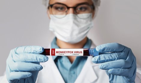 Investigación