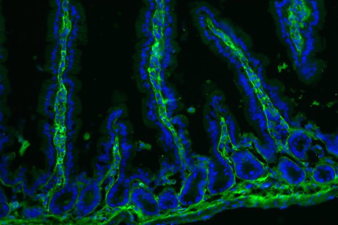 Un estudio de la UPV/EHU demuestra que un compuesto natural evita la inflamación que provoca el gluten en el intestino