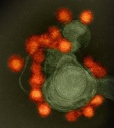 Foto: Nuevos datos prometedores en el tratamiento del neuroblastoma con el  virus del Zika