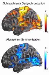 Foto: Un estudio descubre un defecto en las neuronas de las personas con esquizofrenia