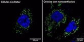 Foto: Identifican un nuevo efecto del uso de nanopartículas de hierro en el crecimiento de células tumorales