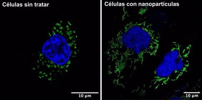 Una célula tumoral donde se aprecian los cambios en la morfología de las mitocondrias (en verde) tras el tratamiento con nanopartículas de óxido de hierro recubiertas con DMSA.