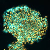 Foto: Las células madre modificadas genéticamente pueden evitar el rechazo inmunológico tras el trasplante