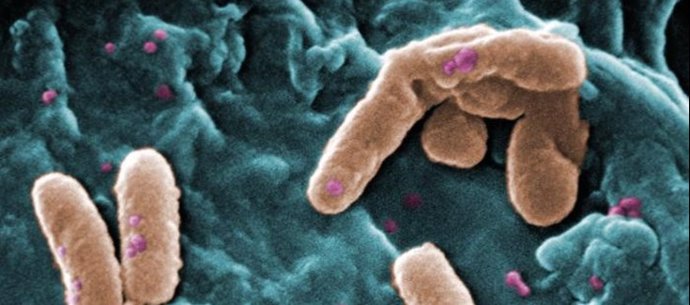 Bacterias, resistencia antimicrobiana.