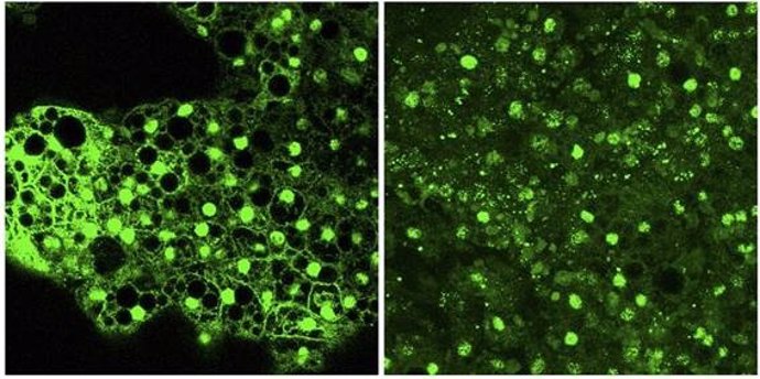 Imagen en la que se observa el desarrollo de los adipocitos (fluorescencia verde) en tejido adiposo procedente de un ratón con mutaciones en la proteína Dido.