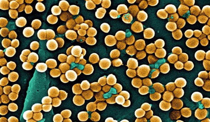 Archivo - Vista de estafilococo dorado ('Staphylococcus aureus') resistente a meticilina.