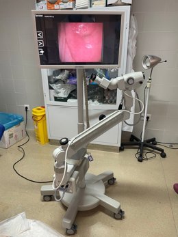 Archivo - Colposcopio para estudiar lesiones precursoras del cáncer de cuello de útero, archivo 