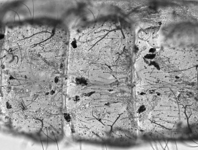 Vista cercana del abdomen de un mosquito que contiene depósitos de melanina oscura.