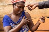 Foto: La OMS pide acabar con "el estigma y discriminación" de la lepra para poder detectar y tratar los casos precozmente