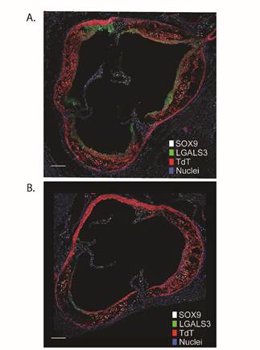 Secciones transversales de aorta de ratones con placas de aterosclerosis tras 20 semanas alimentados con dieta grasa (A) o tras 16 semanas de dieta grasa y 4 semanas de regresión.