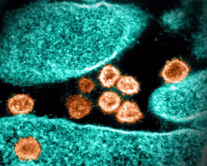 Archivo - Partículas del virus del SARS-CoV-2 emergiendo de la superficie de una célula cultivada en el laboratorio.